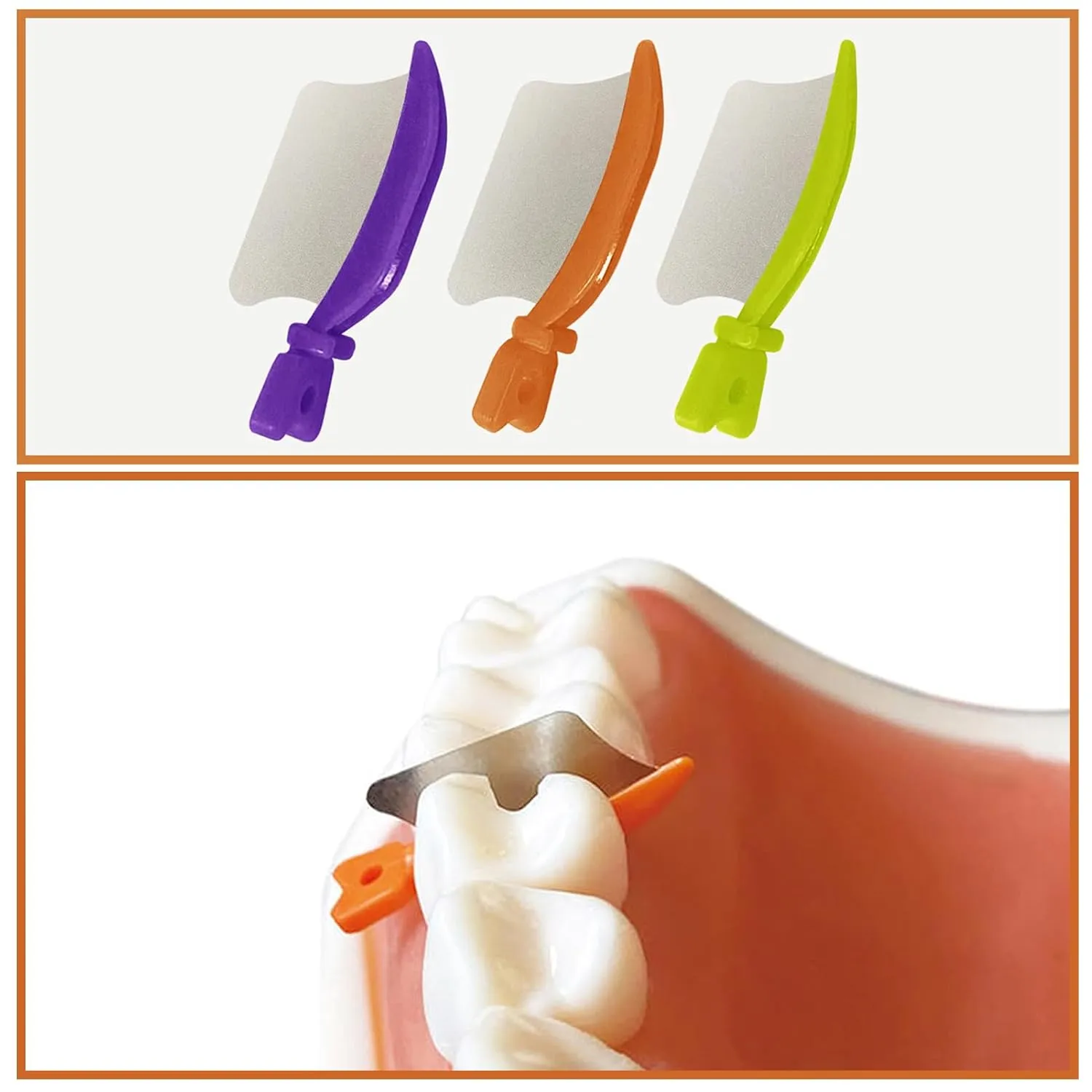 Dental Wedge Knife, Dental Interproximal Plastic Wedge, Dental Wedge Guard with Metal, Dental Plastic Wedges Orthodontic Matrix Wedges for Teeth Interproximal Area. (72PCS)